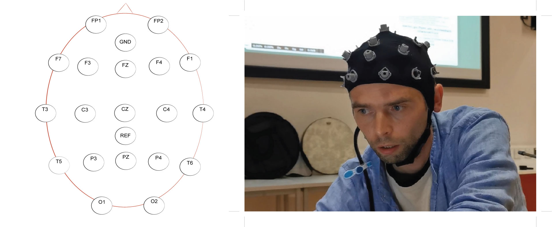 EEG electrode placements with the 10-20 system available on the gel-free cap used with the BCMI-2 system (left) and a photo of this cap on my head recording eight active electrodes (right). Caps can read pre-frontal (FP), frontal (F), temporal (T), parietal (P), occipital (O), and central (C) areas of the brain.