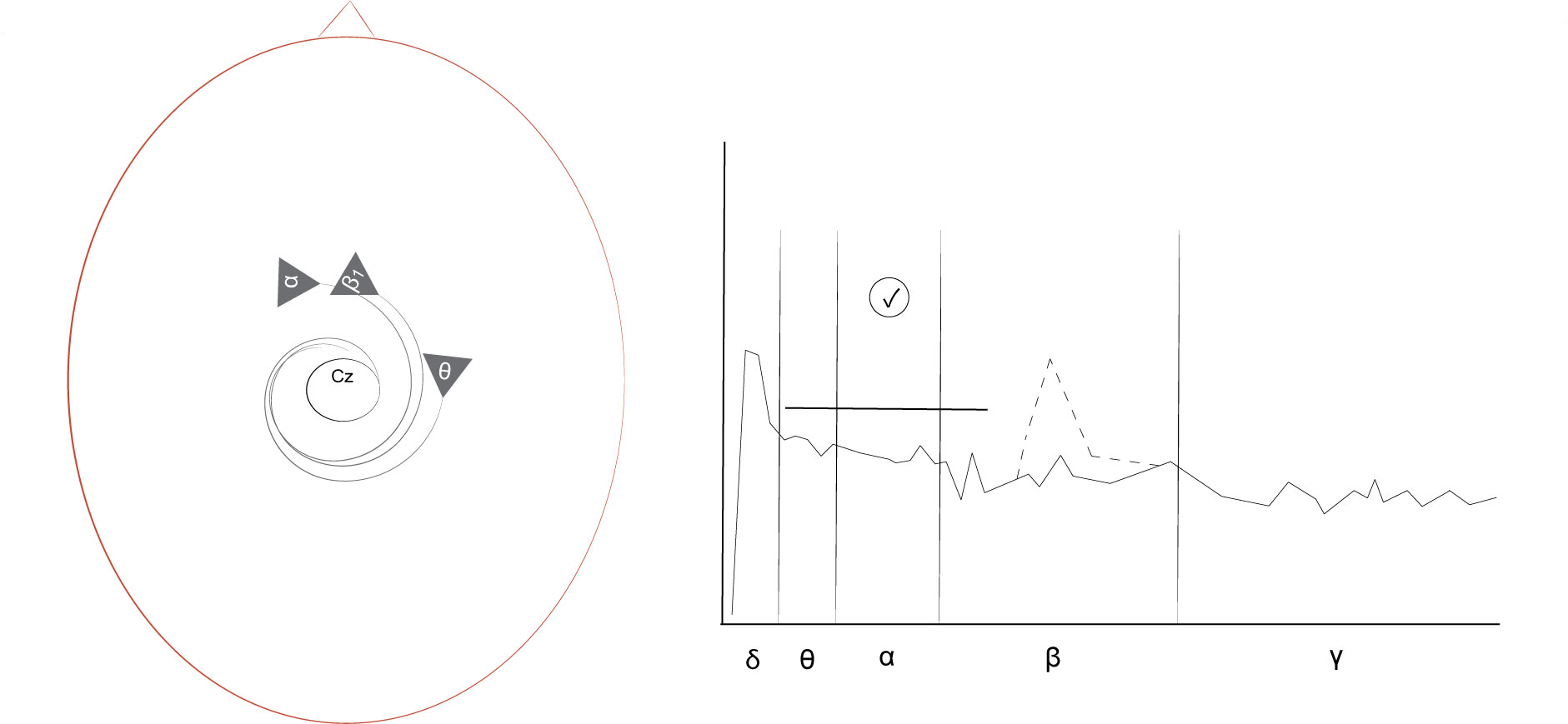 A sharp protocol's electrode location (left) and spectral plot (right) show the application of one wide inhibitor between 4-20 Hz. The peak with the dotted line indicates the brain activity of the particular task performed.