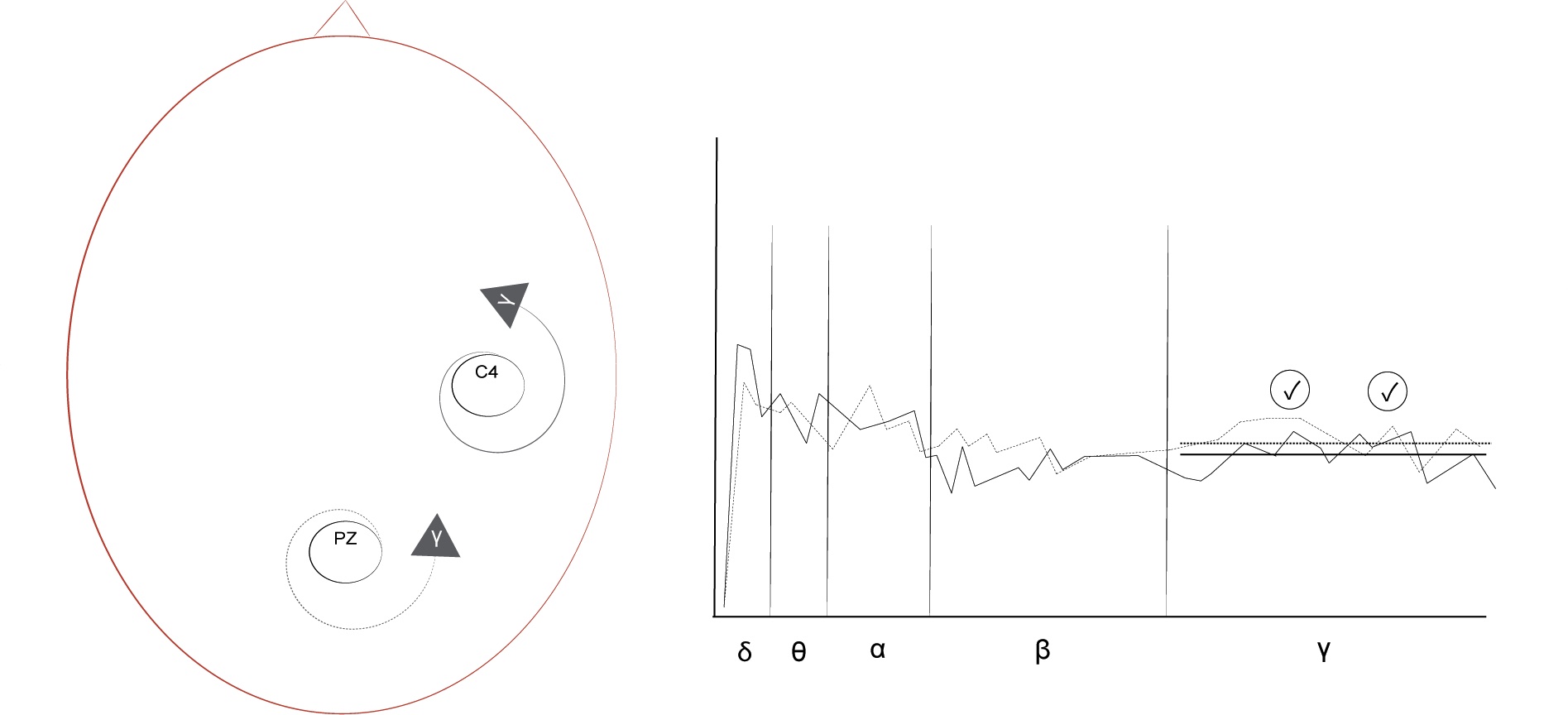 A thoughtful awareness protocol's electrode location (left) and spectral plot (right) showing the application of two gamma indicators.
