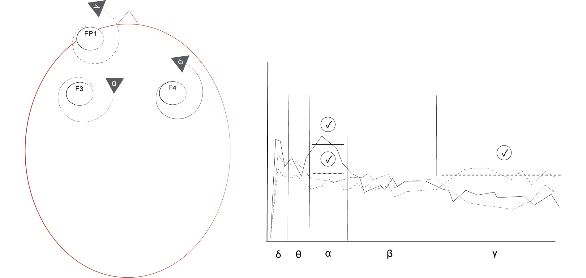 A open heart protocol's electrode location (left) and spectral plot (right) show the application of one indicator on the right hemisphere (F4) and one inhibitor on the left hemisphere (F4), with the addition of another indicator on FP1 rewarding increased gamma.